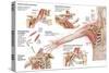Medical Illustration Detailing Thoracic Outlet Syndrome-null-Stretched Canvas