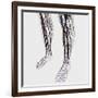 Medical Illustration of Arteries, Veins And Lymphatic System in Human Legs-Stocktrek Images-Framed Photographic Print