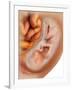 Medical Illustration of Fetus Development at 36 Weeks-null-Framed Art Print