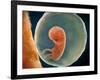 Medical Illustration of Fetus Development at 9 Weeks-null-Framed Art Print