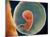 Medical Illustration of Fetus Development at 9 Weeks-null-Mounted Art Print