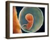Medical Illustration of Fetus Development at 9 Weeks-null-Framed Art Print