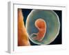 Medical Illustration of Fetus Development at 9 Weeks-null-Framed Art Print