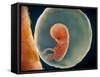 Medical Illustration of Fetus Development at 9 Weeks-null-Framed Stretched Canvas