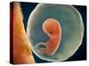 Medical Illustration of Fetus Development at 9 Weeks-null-Stretched Canvas