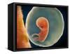 Medical Illustration of Fetus Development at 9 Weeks-null-Framed Stretched Canvas