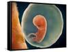 Medical Illustration of Fetus Development at 9 Weeks-null-Framed Stretched Canvas