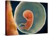 Medical Illustration of Fetus Development at 9 Weeks-null-Stretched Canvas