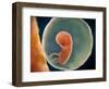 Medical Illustration of Fetus Development at 9 Weeks-null-Framed Art Print