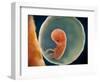 Medical Illustration of Fetus Development at 9 Weeks-null-Framed Art Print