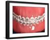 Medical Illustration of Human Mouth Showing Teeth, Gums and Metal Braces-null-Framed Art Print