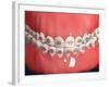 Medical Illustration of Human Mouth Showing Teeth, Gums and Metal Braces-null-Framed Art Print