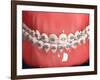 Medical Illustration of Human Mouth Showing Teeth, Gums and Metal Braces-null-Framed Art Print