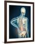 Medical Illustration Showing Inflammation in Human Back Are-null-Framed Art Print