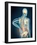 Medical Illustration Showing Inflammation in Human Back Are-null-Framed Art Print