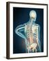 Medical Illustration Showing Inflammation in Human Back Are-null-Framed Art Print