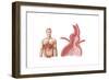 Medical Ilustration of a Hiatal Hernia in the Upper Part of the Stomach into the Thorax-null-Framed Art Print