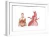 Medical Ilustration of a Hiatal Hernia in the Upper Part of the Stomach into the Thorax-null-Framed Art Print