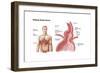 Medical Ilustration of a Hiatal Hernia in the Upper Part of the Stomach into the Thorax-null-Framed Art Print