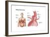 Medical Ilustration of a Hiatal Hernia in the Upper Part of the Stomach into the Thorax-null-Framed Art Print