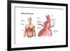 Medical Ilustration of a Hiatal Hernia in the Upper Part of the Stomach into the Thorax-null-Framed Art Print