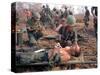 Medics Treat Wounded-Associated Press-Stretched Canvas
