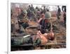 Medics Treat Wounded-Associated Press-Framed Photographic Print