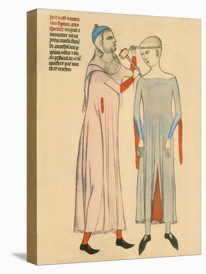 Medieval Doctor Cutting Open a Patient's Skull with a Hammer and Blade, 1300's-null-Stretched Canvas