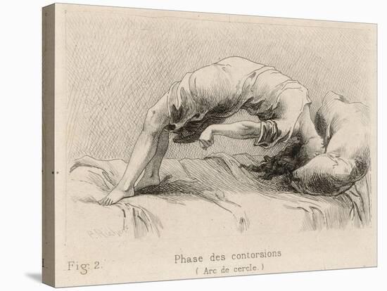 Mental Patient at la Salpetriere Going Through the Phase of Contortions-P. Richer-Stretched Canvas