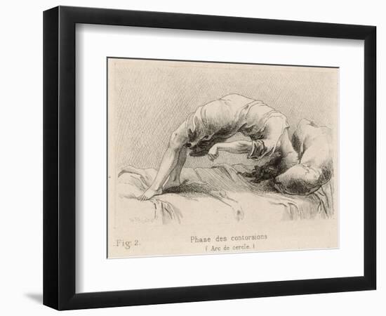Mental Patient at la Salpetriere Going Through the Phase of Contortions-P. Richer-Framed Photographic Print