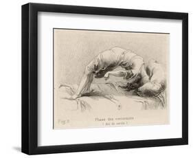 Mental Patient at la Salpetriere Going Through the Phase of Contortions-P. Richer-Framed Photographic Print