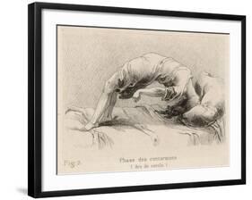 Mental Patient at la Salpetriere Going Through the Phase of Contortions-P. Richer-Framed Photographic Print