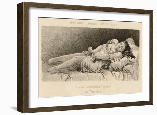 Mental Patient at la Salpetriere in Phase of Tonic Immobility-P. Richer-Framed Art Print