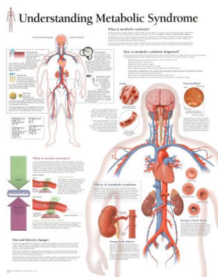 Poster, , large