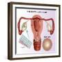 Methods of Female Birth Control-Gwen Shockey-Framed Giclee Print