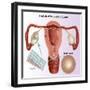 Methods of Female Birth Control-Gwen Shockey-Framed Giclee Print