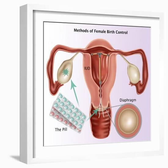 Methods of Female Birth Control-Gwen Shockey-Framed Giclee Print