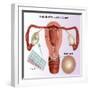 Methods of Female Birth Control-Gwen Shockey-Framed Giclee Print
