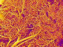 Blood Vessel Cast from Rat Pancreas-Micro Discovery-Photographic Print
