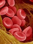 Coagulated Red Blood Cells-Micro Discovery-Photographic Print