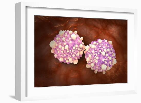 Microscipic View of Pancreatic Cancer Cells-null-Framed Art Print