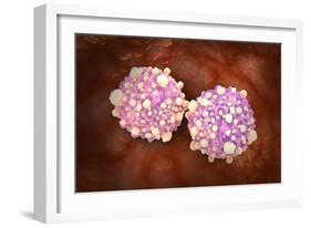 Microscipic View of Pancreatic Cancer Cells-null-Framed Art Print