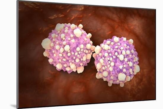Microscipic View of Pancreatic Cancer Cells-null-Mounted Art Print