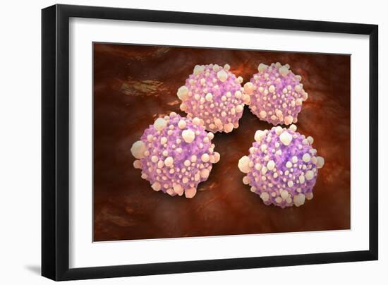 Microscipic View of Pancreatic Cancer Cells-null-Framed Art Print