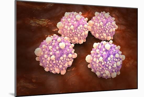 Microscipic View of Pancreatic Cancer Cells-null-Mounted Art Print