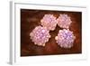 Microscipic View of Pancreatic Cancer Cells-null-Framed Art Print