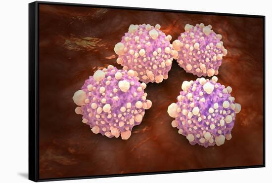 Microscipic View of Pancreatic Cancer Cells-null-Framed Stretched Canvas