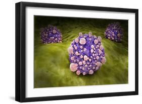 Microscipic View of Pancreatic Cancer Cells-null-Framed Premium Giclee Print