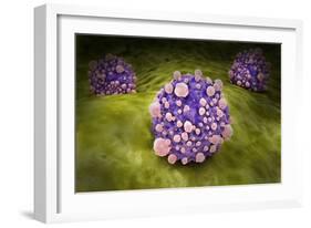 Microscipic View of Pancreatic Cancer Cells-null-Framed Premium Giclee Print