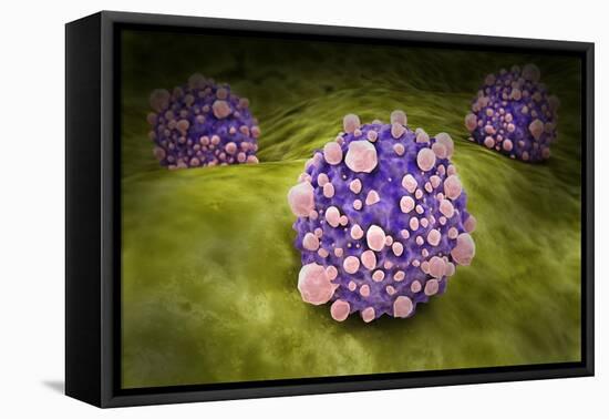 Microscipic View of Pancreatic Cancer Cells-null-Framed Stretched Canvas